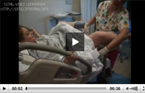 Видео роды с эпидуральной анестезией